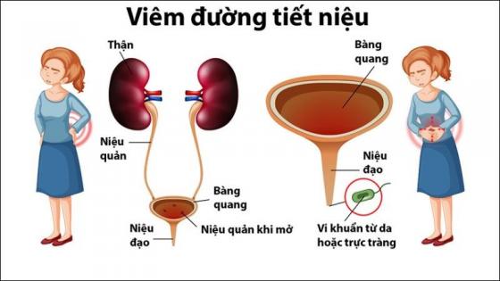 1735571899549669.jpg tieu-buot3-800x450.jpg